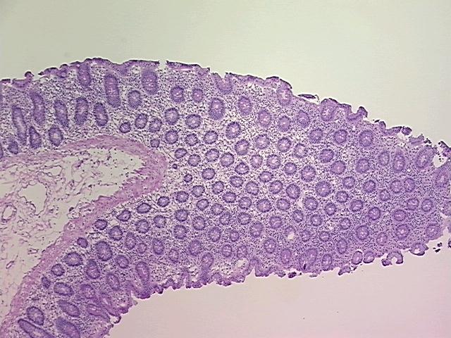 4x Image