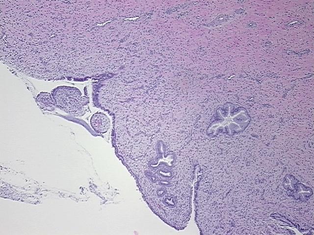 4x Image