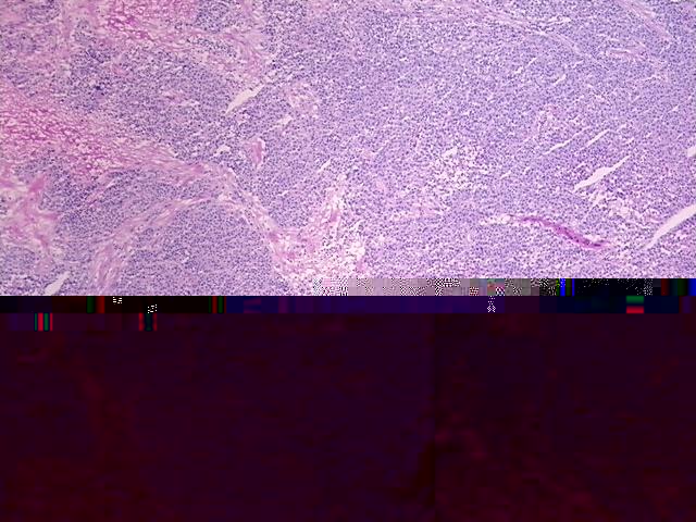 4x Image