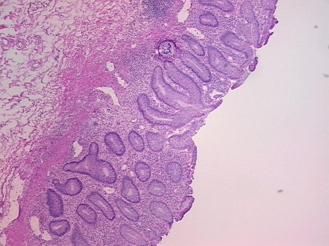 4x Image