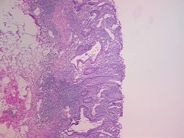 4x Image