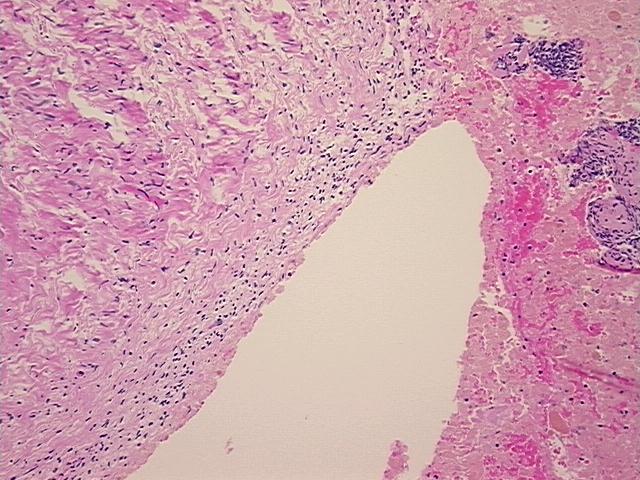 4x Image
