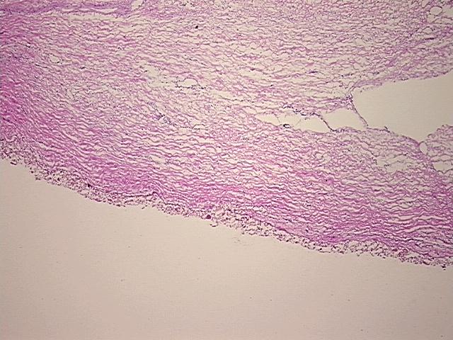 4x Image