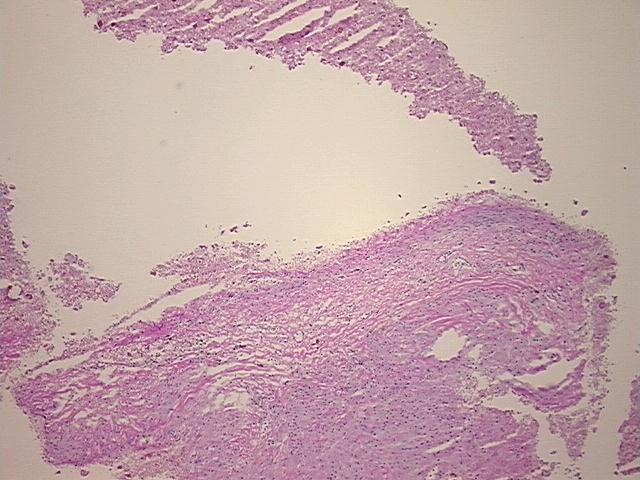 4x Image