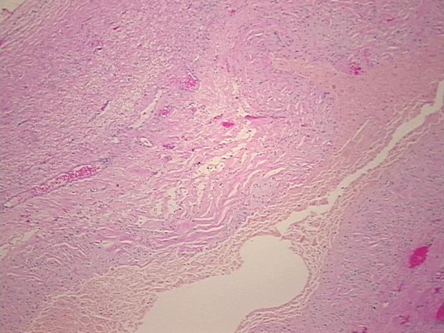 4x Image