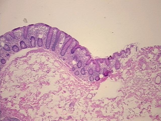 4x Image