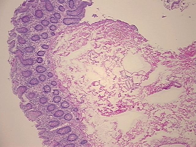 4x Image