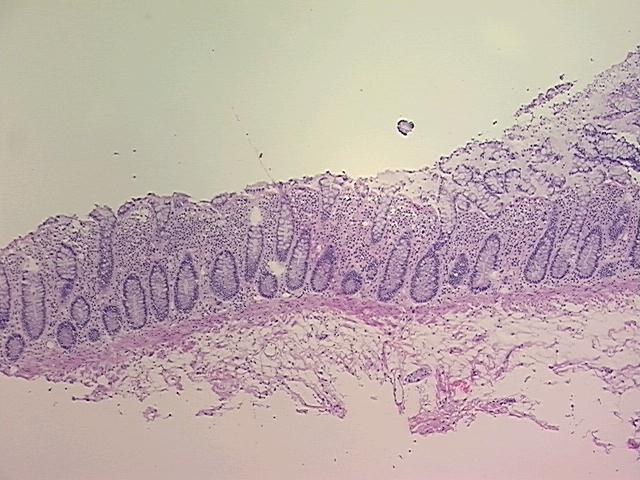 4x Image