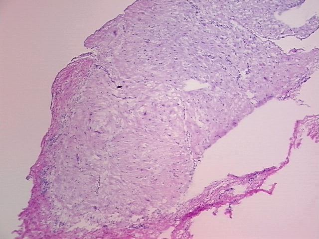 4x Image