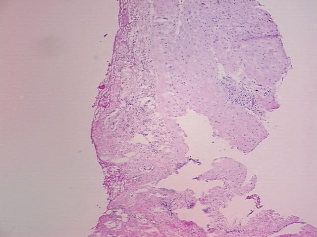 4x Image