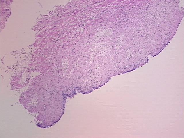 4x Image