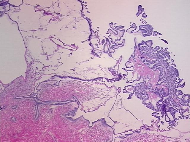 4x Image