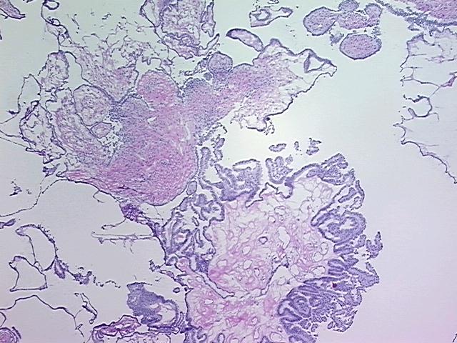 4x Image