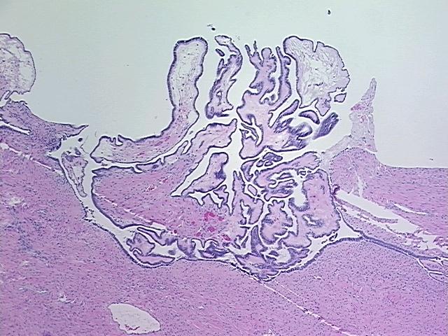 4x Image