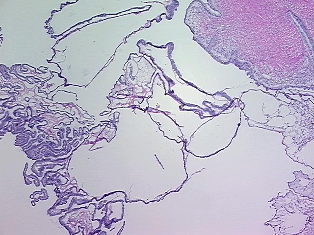 4x Image