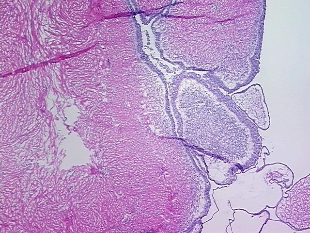 4x Image