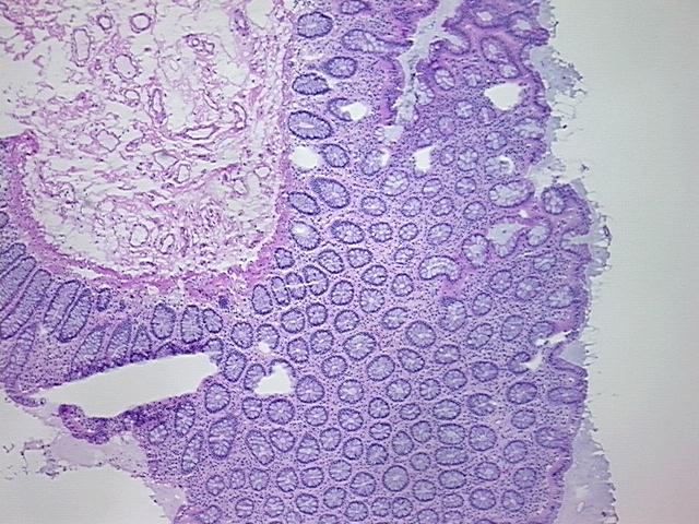 4x Image