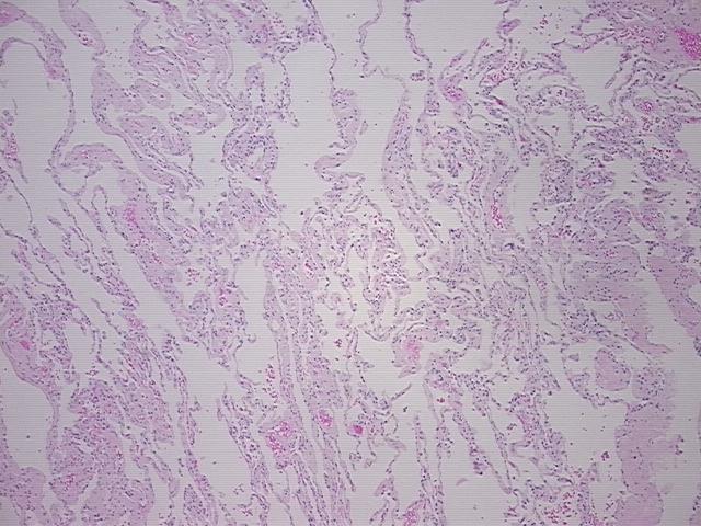 4x Image