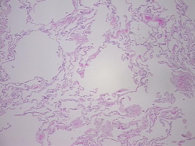 4x Image