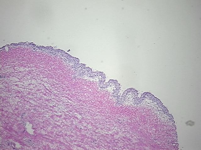 4x Image