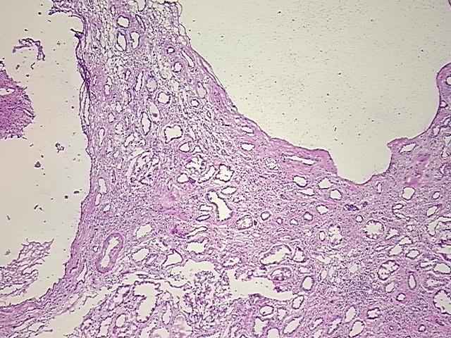4x Image
