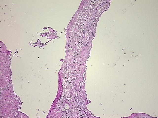 4x Image
