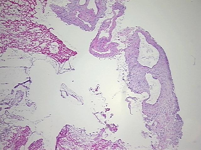 4x Image
