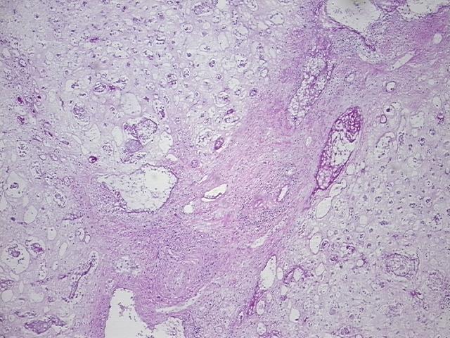 4x Image