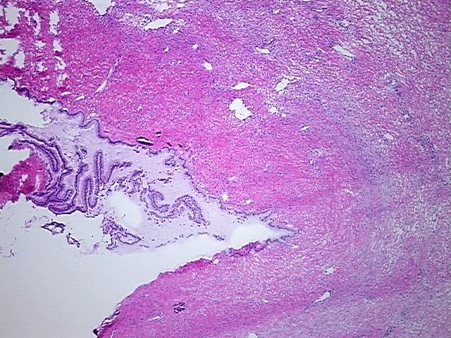 4x Image