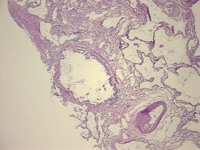 4x Image