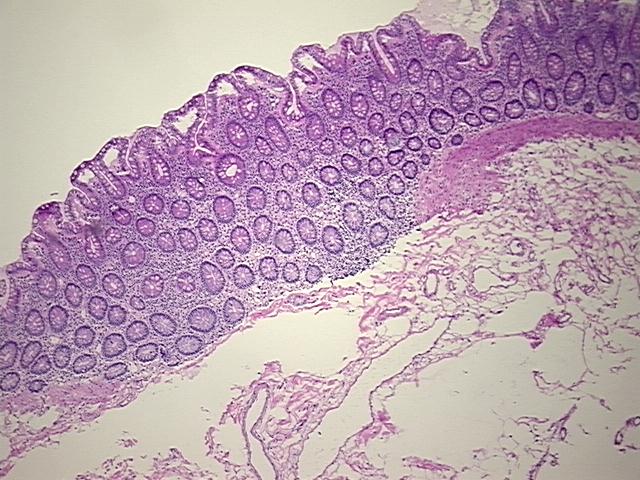 4x Image