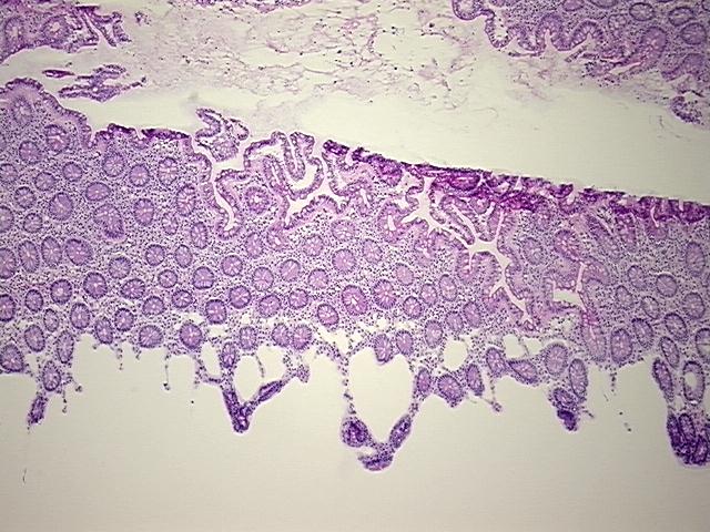 4x Image