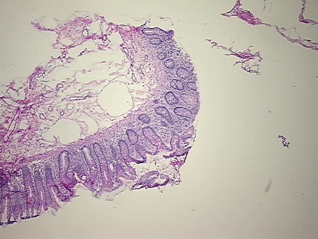 4x Image