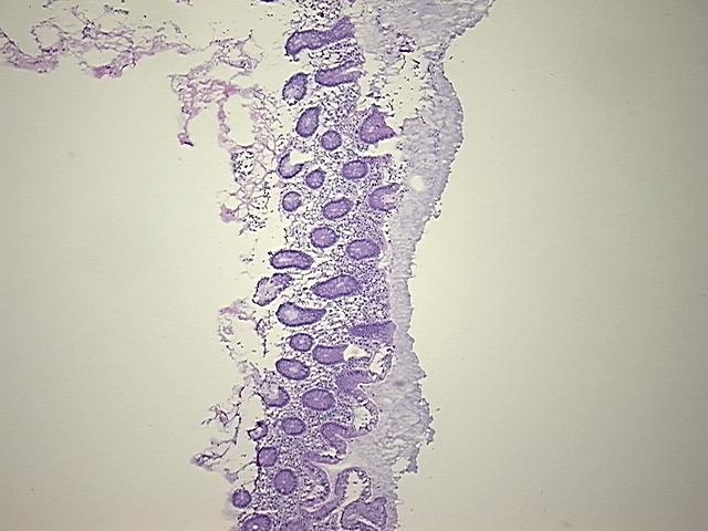 4x Image