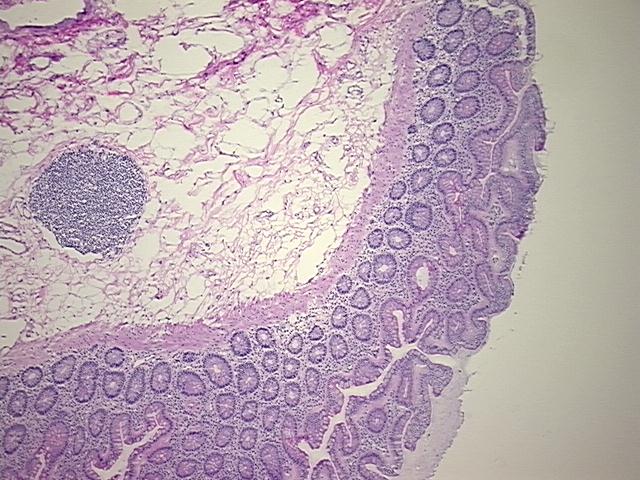 4x Image