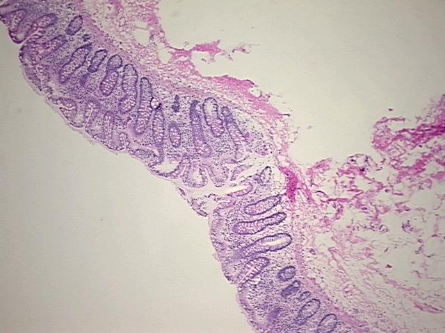 4x Image