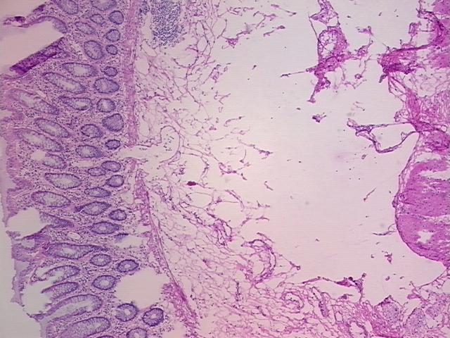 4x Image