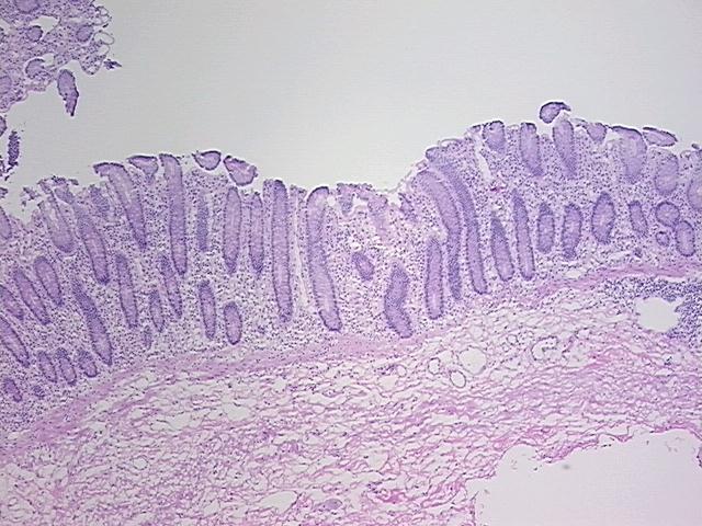 4x Image