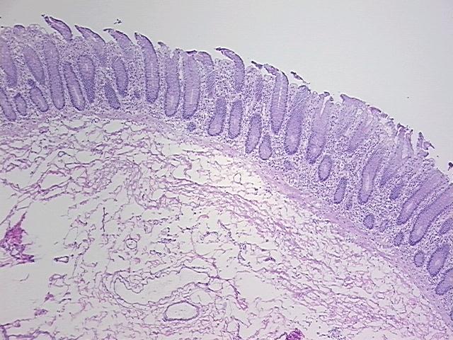 4x Image