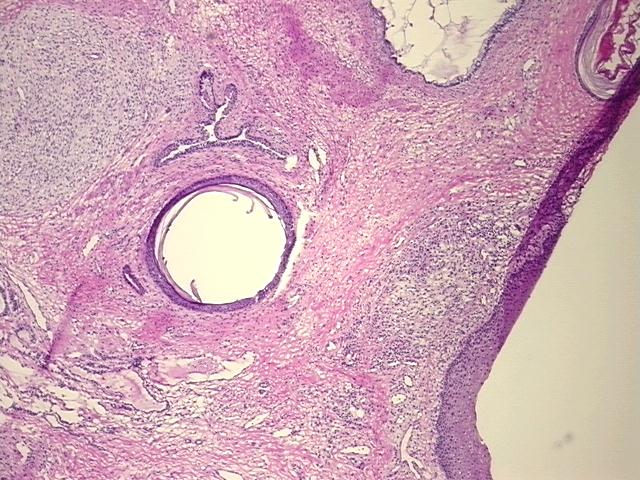 4x Image