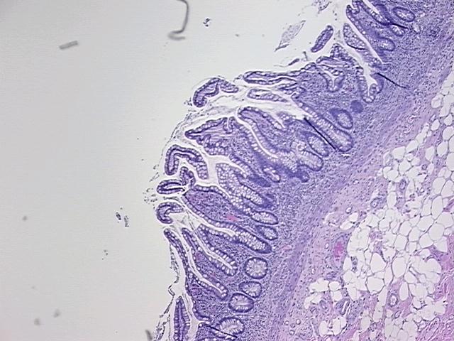 4x Image