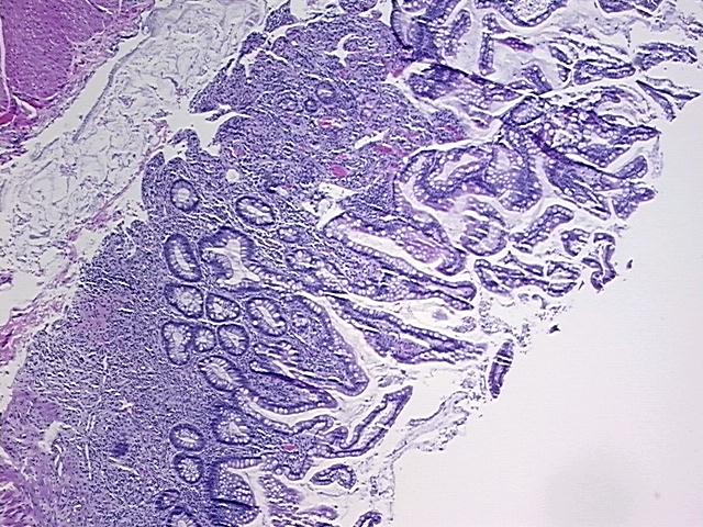 4x Image