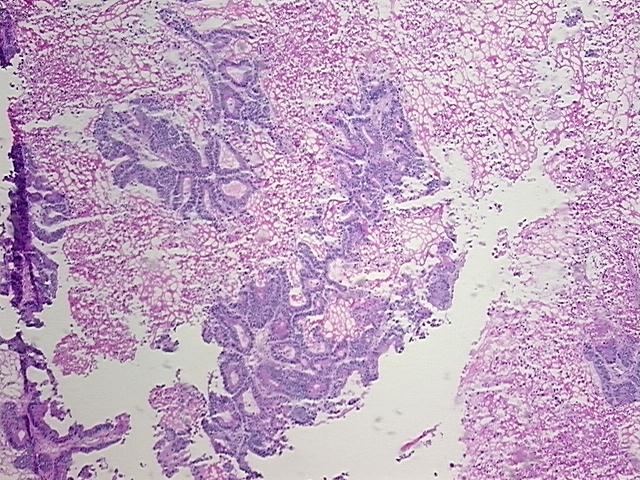 4x Image