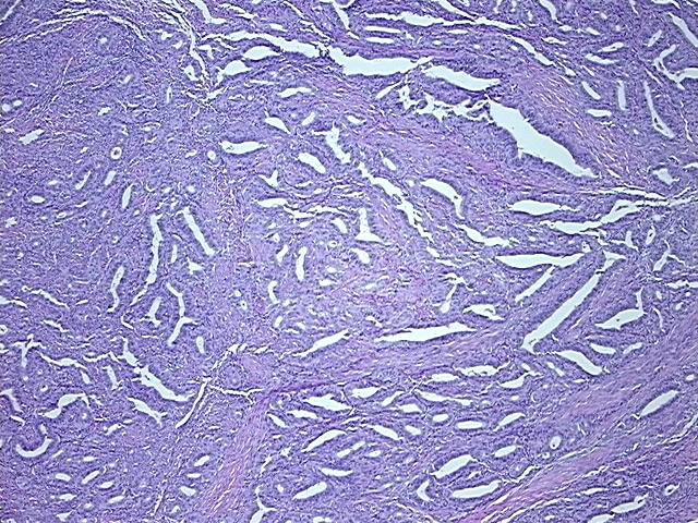 4x Image