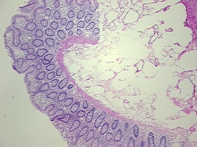 4x Image