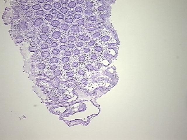 4x Image