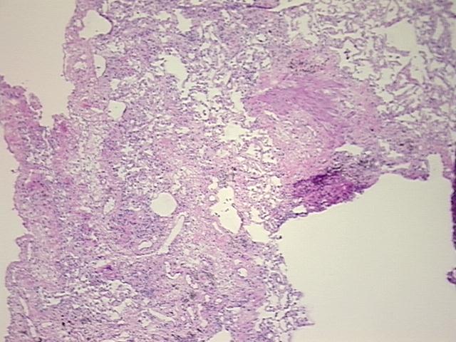 4x Image
