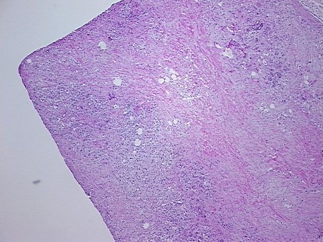 4x Image