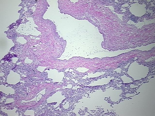 Frozen Tissue Sections, Lung