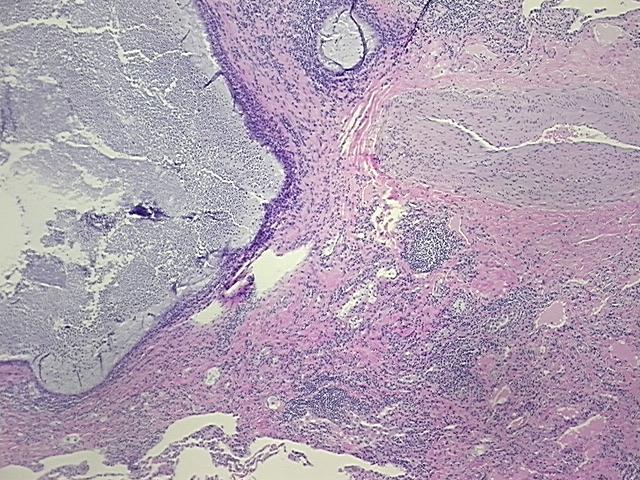 Tissue FFPE Sections, Lung